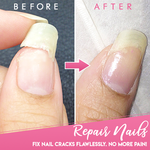 CRACKED NAIL® REPAIR GEL